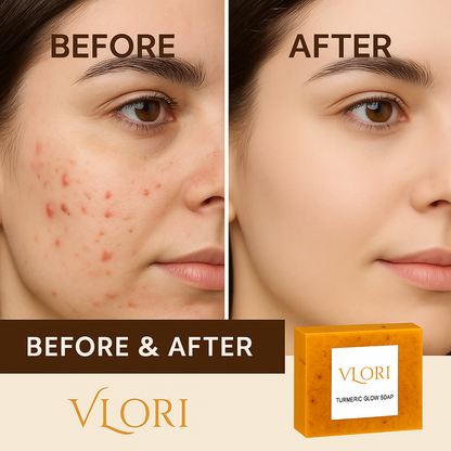 Vlori  Face Soap